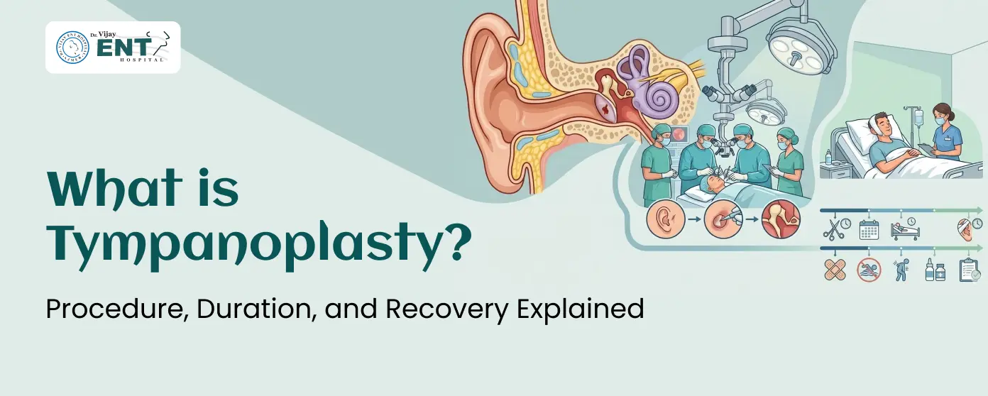 What is Tympanoplasty? Procedure, Duration, and Recovery Explained