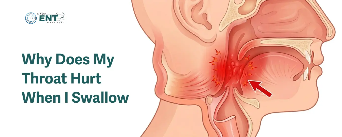 Why Does My Throat Hurt When I Swallow
