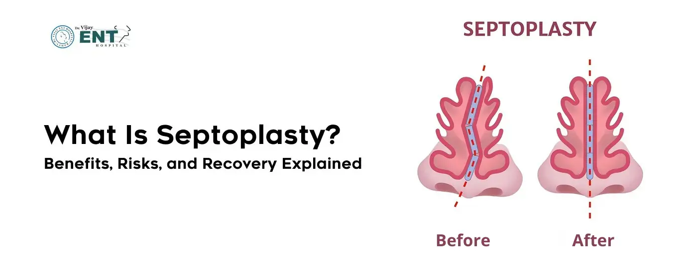 What Is Septoplasty? Benefits, Risks, and Recovery Explained