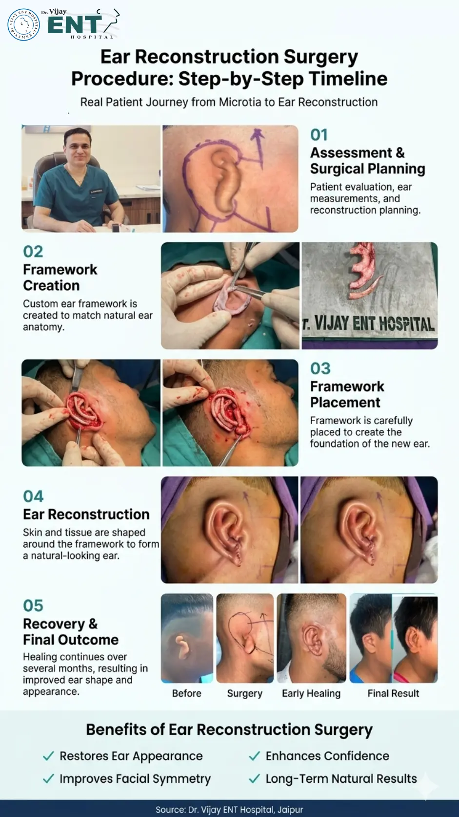 Ear Reconstruction Surgery Procedure Step-by-Step Timeline