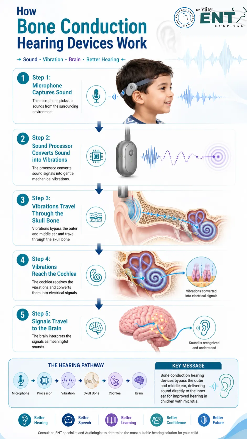 How Bone Conduction Hearing Devices Work