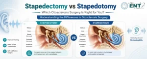 Stapedectomy vs Stapedotomy: Which Surgery Is Better for Otosclerosis?