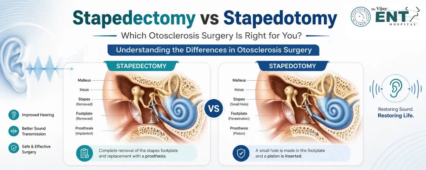 Stapedectomy vs Stapedotomy: Which Surgery Is Better for Otosclerosis?