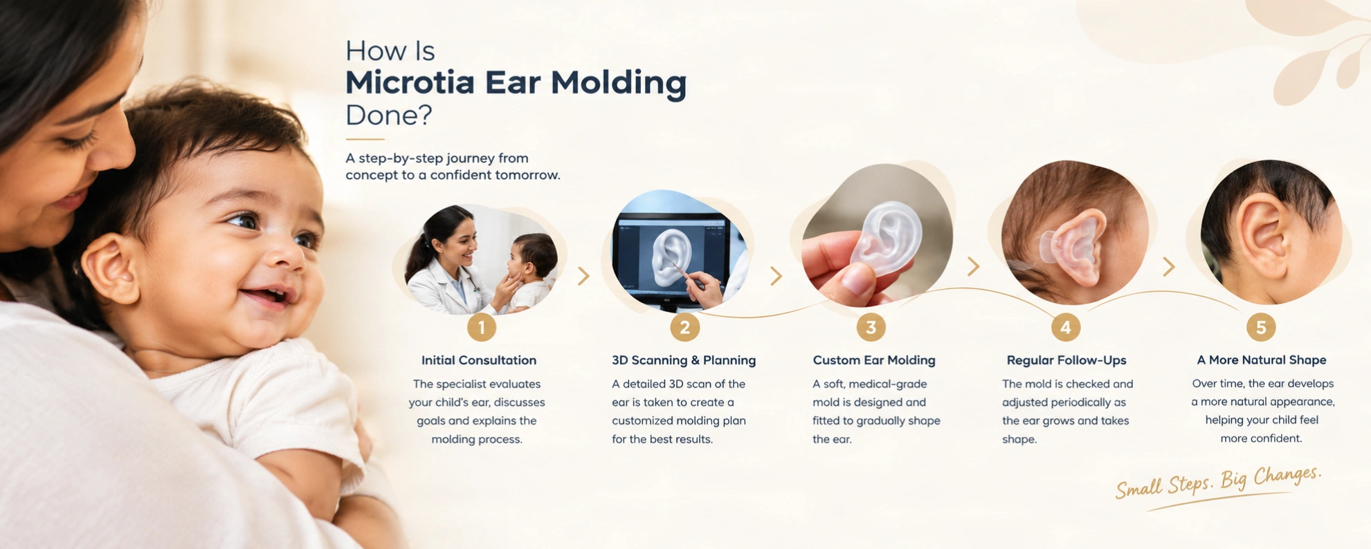 How Is Microtia Ear Molding Done
