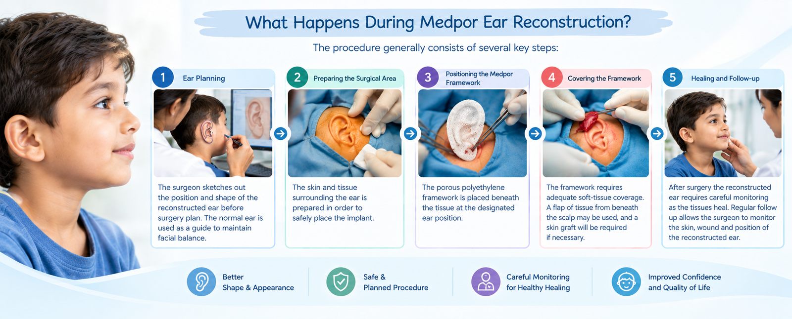 Medpor Ear Reconstruction
