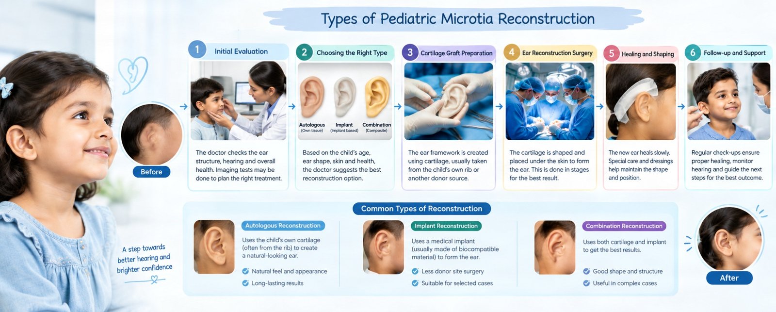 Pediatric Microtia Reconstruction: A Caring Journey