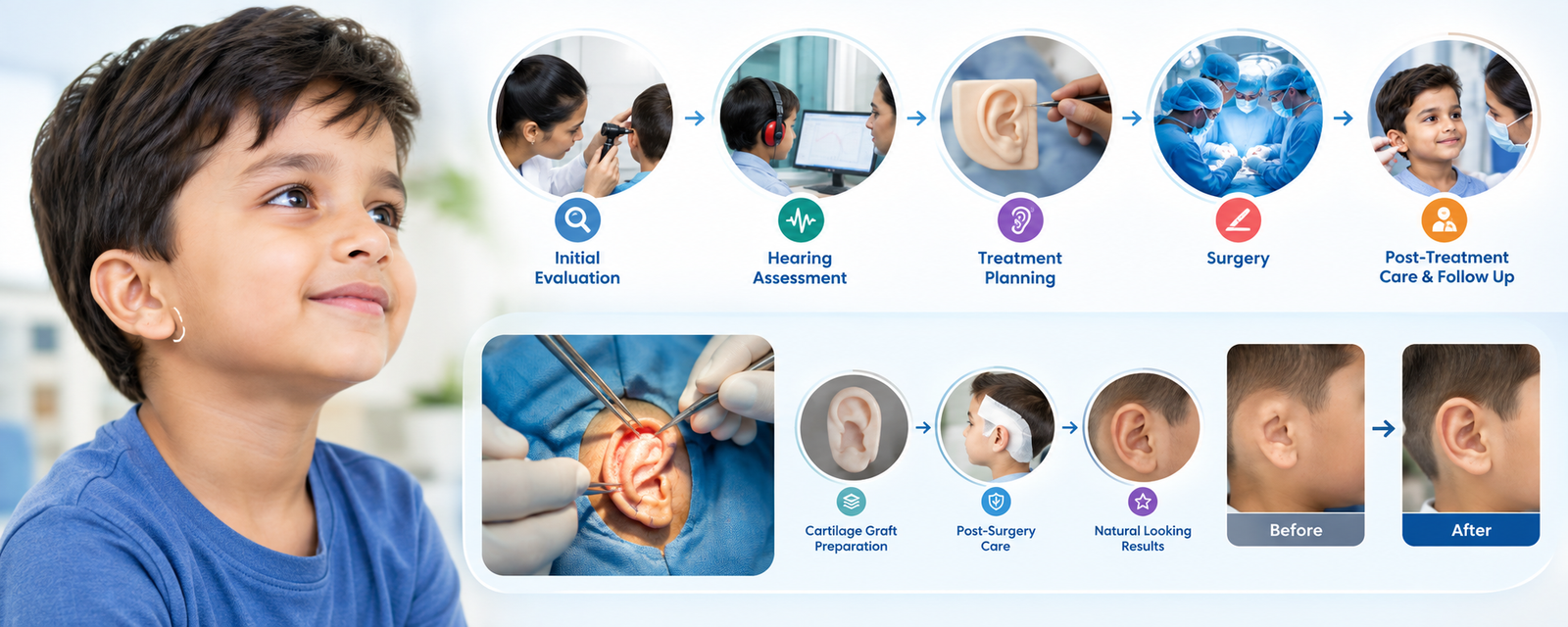 Pediatric Microtia- Treatment and Surgery for Children